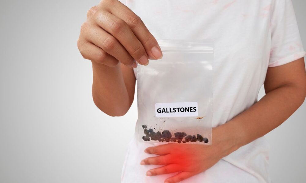 Diagnosed with Gallstones