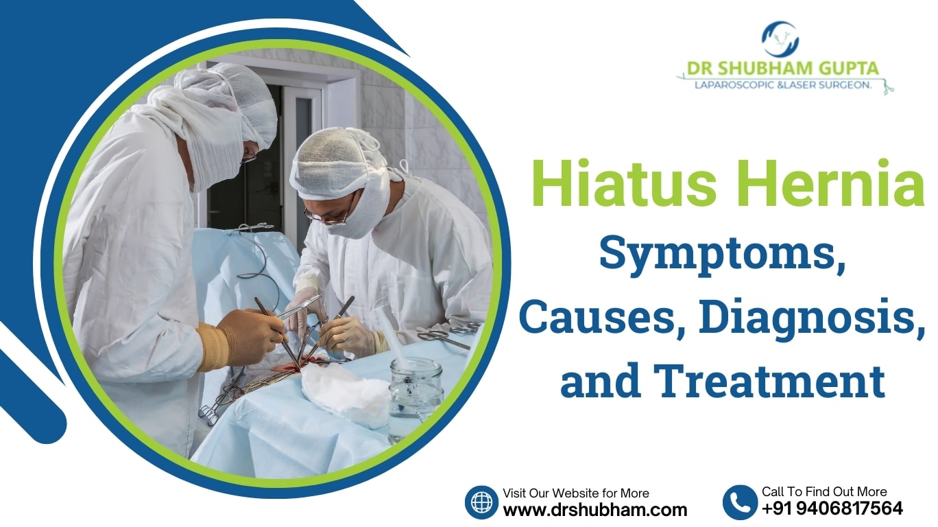 Hiatus Hernia – Symptoms, Causes, Diagnosis, and Treatment