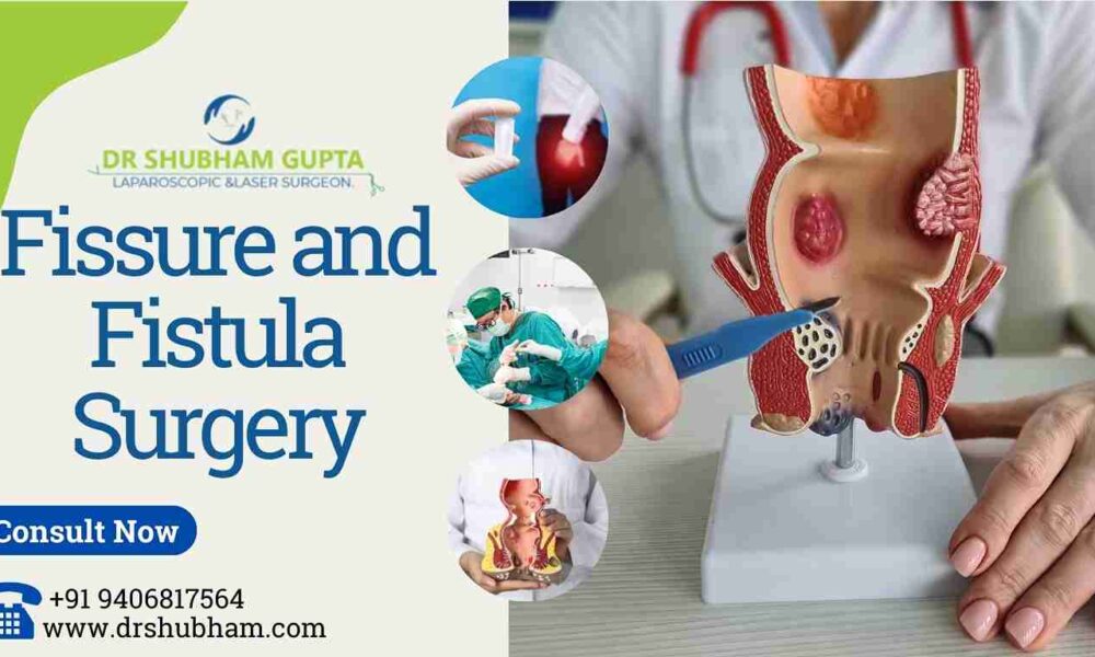 Fissure and Fistula Surgery