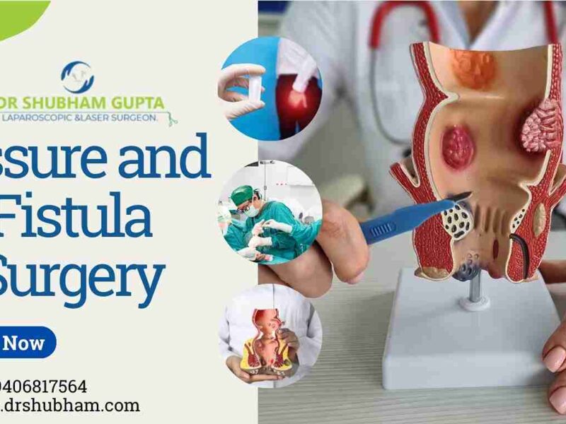 Fissure and Fistula Surgery: Causes, Types, and Treatment