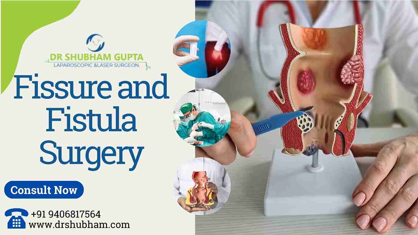 Fissure and Fistula Surgery: Causes, Types, and Treatment