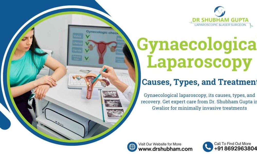 Gyno Laproscopy