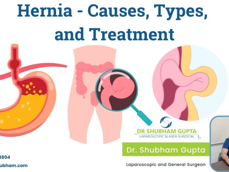 Understanding Hernia: Causes, Types, and Treatment