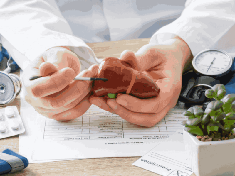 Understanding Kidney Stones: Causes, Symptoms, and Treatment