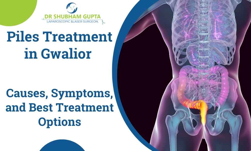 Piles Treatment in Gwalior: Causes, Symptoms, and Best Treatment Options