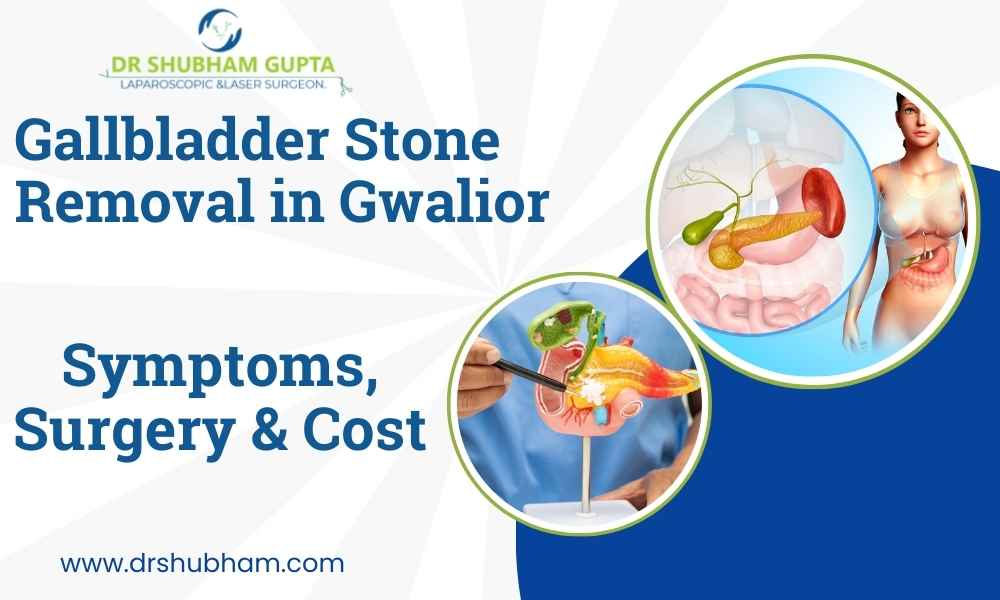 Gallbladder Stone Removal in Gwalior: Symptoms, Surgery & Cost