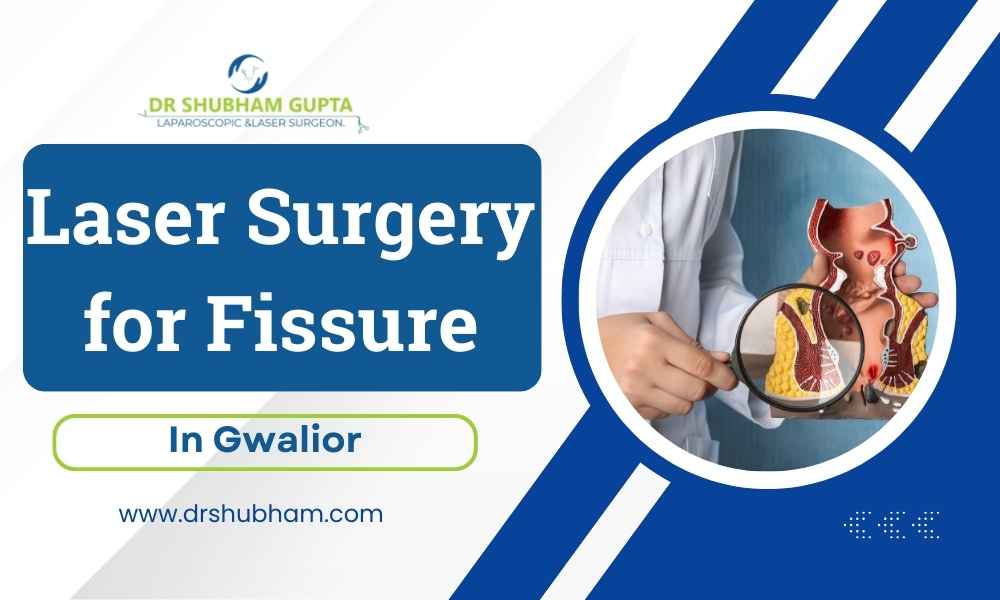 Laser Surgery for Fissure in Gwalior – Dr. Shubham Gupta